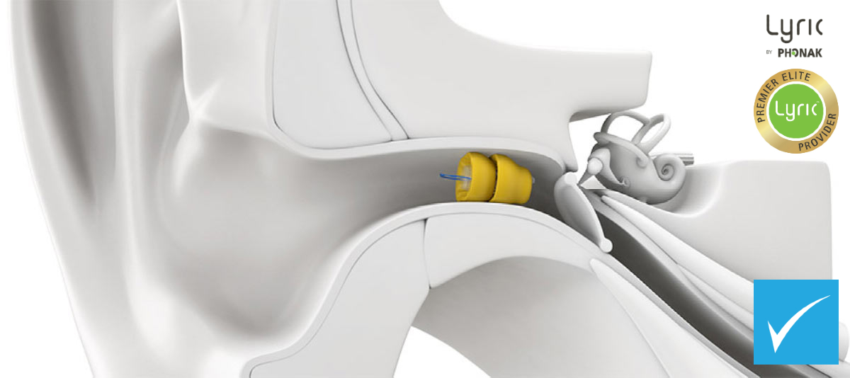 FREE Trial of Phonak Lyric FREE Trial of Phonak Lyric