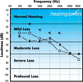 Audiogram HEARING SAVERS